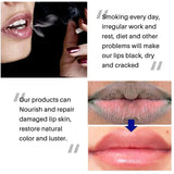 Lip Balm Remove Dark Lips Lightening Melanin Essence