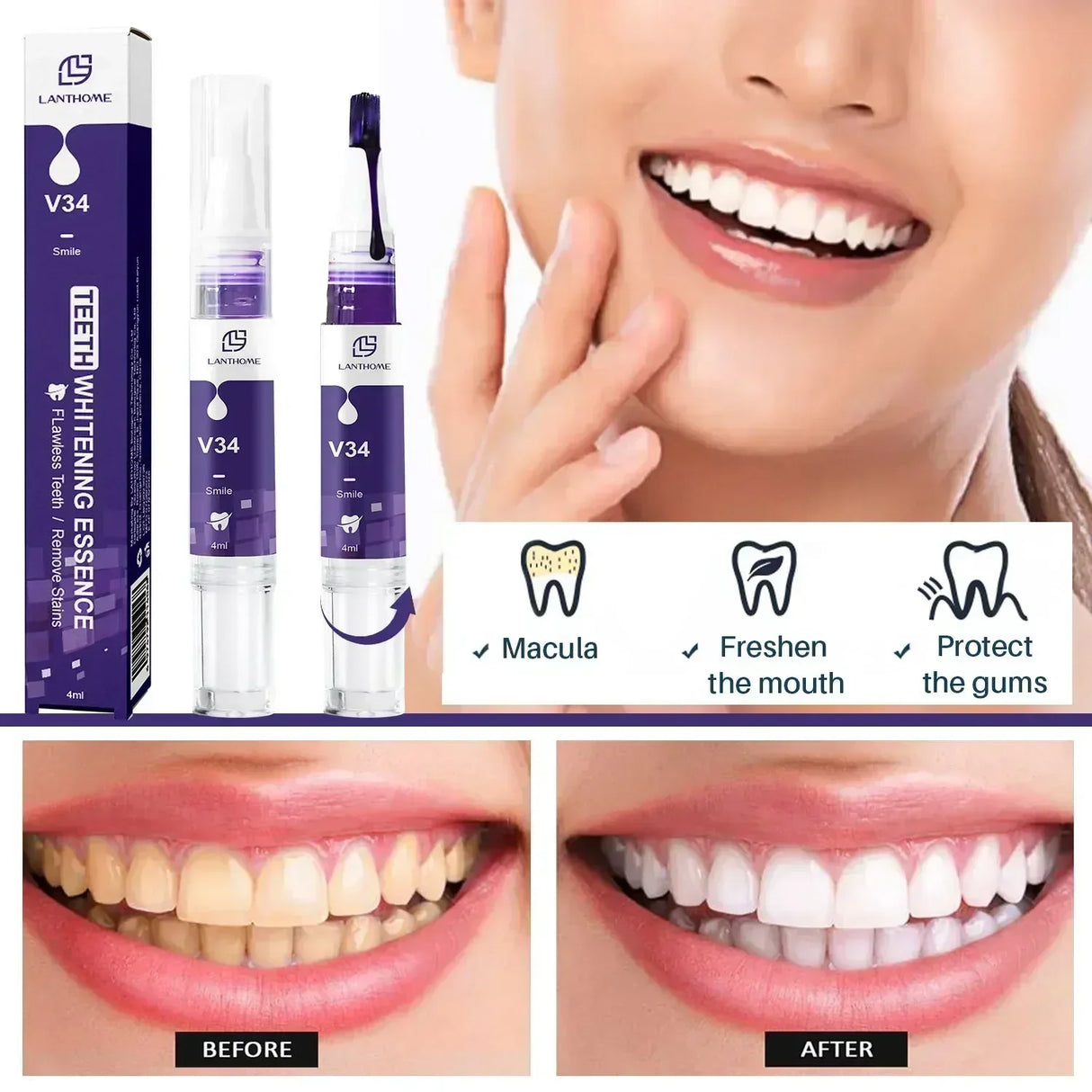 Teeth Whtening Toothpaste Pen Tooth Gel Brighten