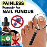 Days Repair Nail Fungus Treatments Essence Foot Care