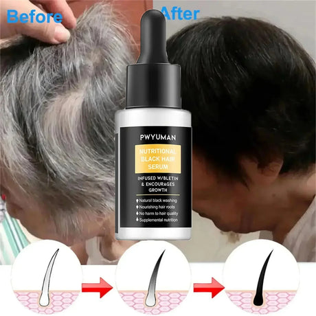 Gray White Hair Treatment Serum Oil White