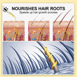 Purc Hair Growth For Men Women Products Ginger