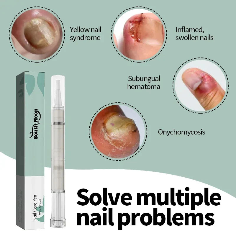 Nail Treatment Pen Anti Fungal Nail Ingrown Cream