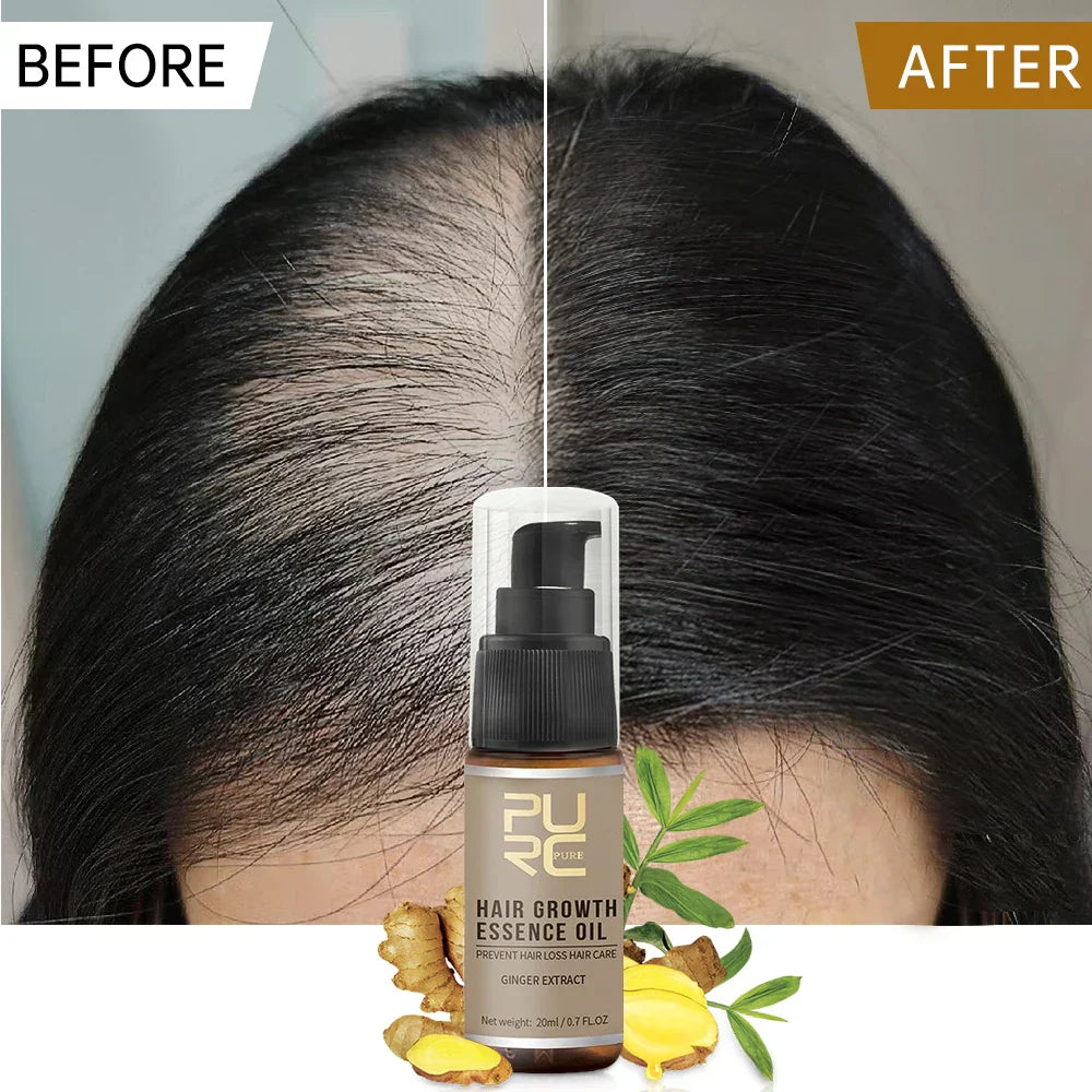 Purc Hair Growth Oil For Men Women Anti