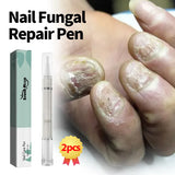 Nail Treatment Pen Anti Fungal Nail Ingrown Cream