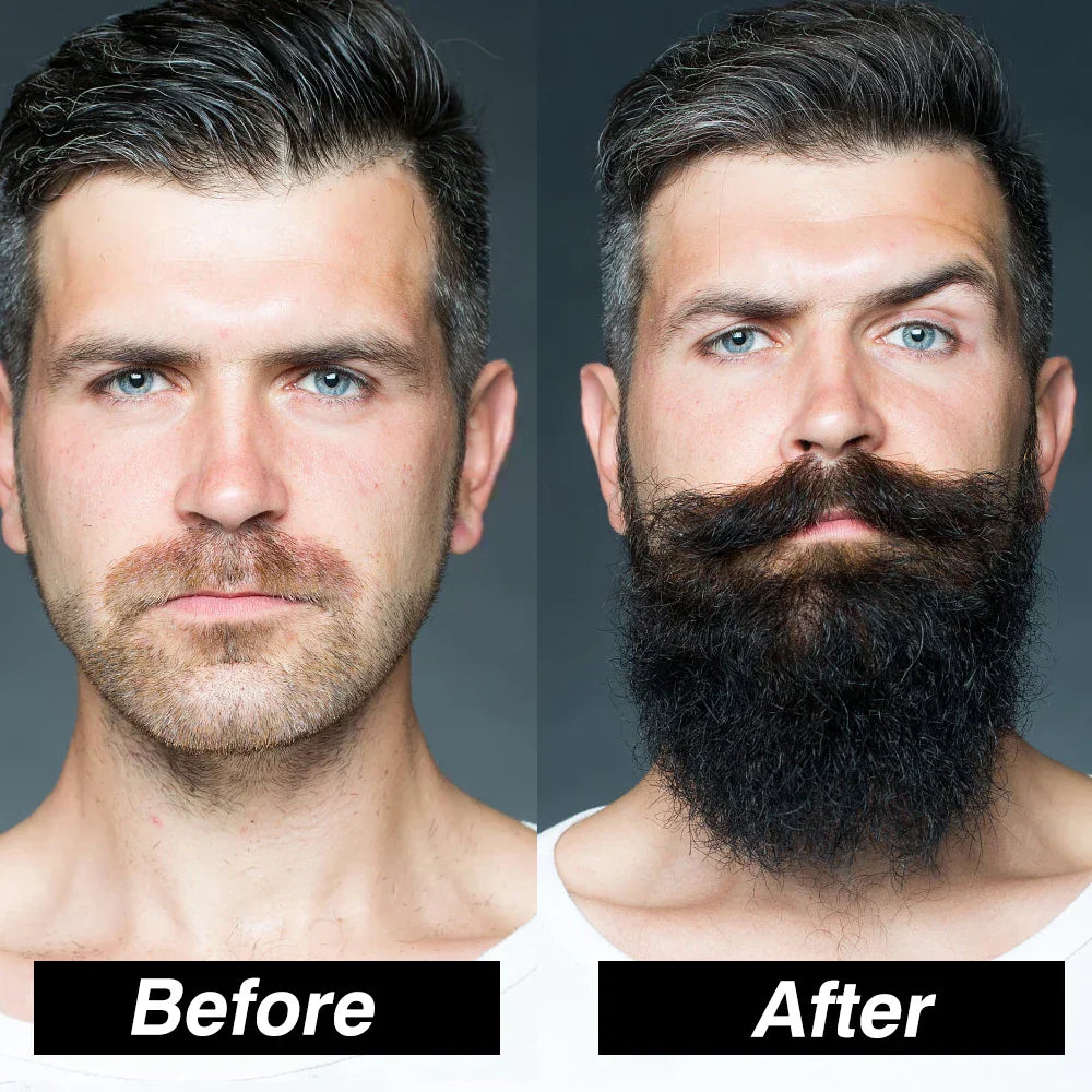 Beard Growth Kit Men Hair Enhancer Thicker