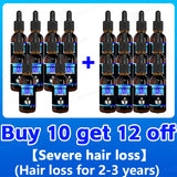 Hair Growth Essence Can Quickly Grow Hair