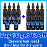 Hair Growth Essence Can Quickly Grow Hair