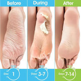 Pair Honey Foot Mask For Remove