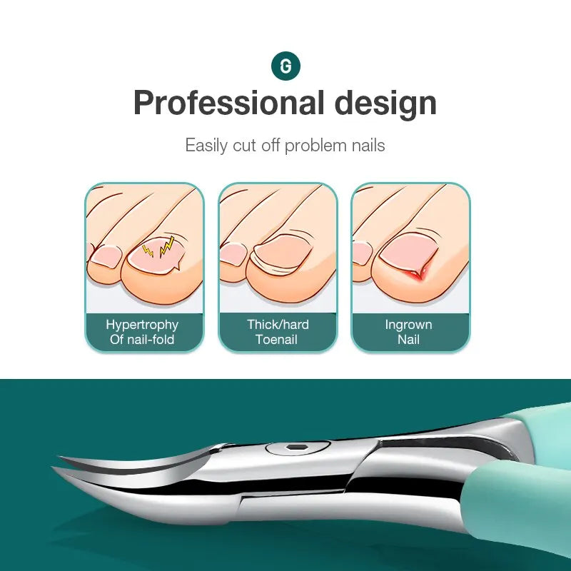 Mr.Green Toenail Clippers Anti-Splash Ingrown Nail Olecranon Cutters