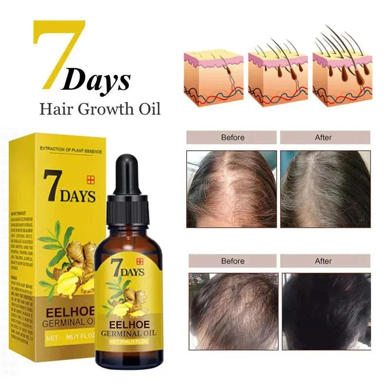 Days Fast Ginger Hair Growth Serum Anti-Loss Hair