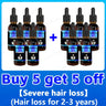 Hair Growth Essence Can Quickly Grow Hair