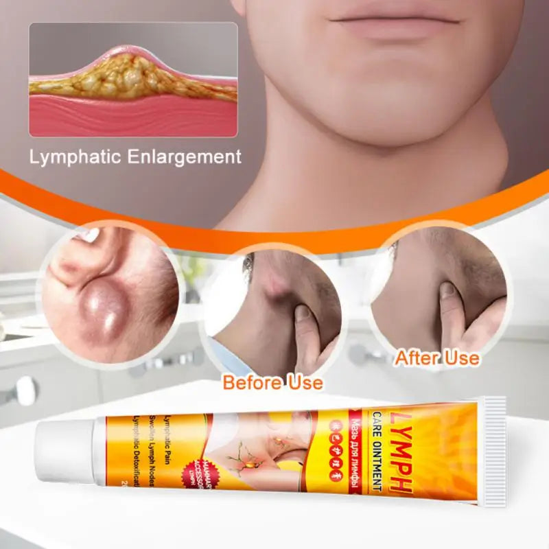 Lymphatic Detox Cream Lymph Ointment Neck Anti-Swelling