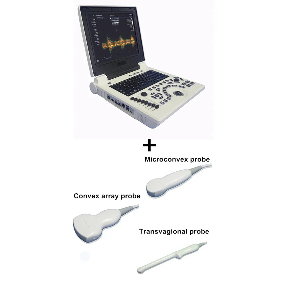 D Based Notebook Black White Ultrasound Scanner Pw