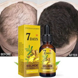 Days Fast Ginger Hair Growth Serum Anti-Loss Hair