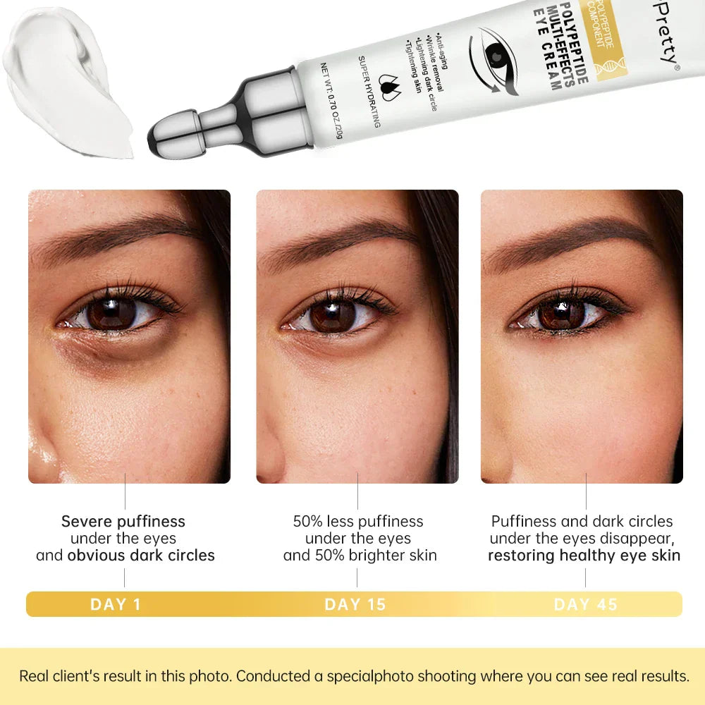 Eye Cream Eye Bags Removal Under