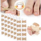 Ingrown Toenail Corrector Patches Nail Correction Care