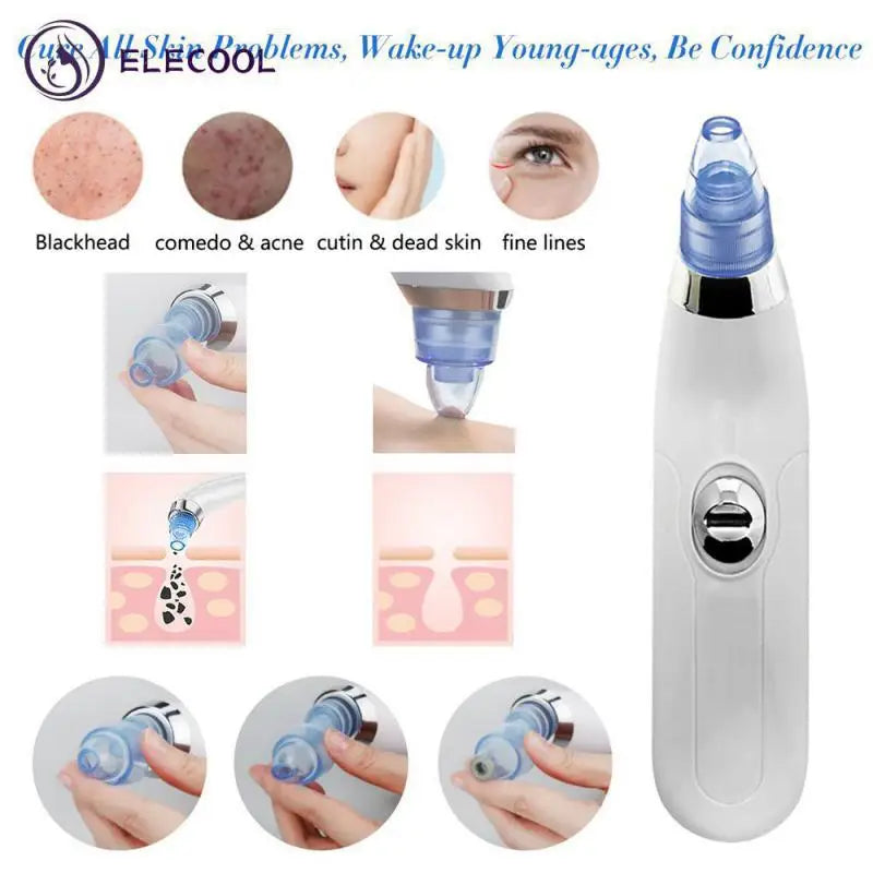 Electric Acne Remover Facial Cleaner Nose Blackhead Remover