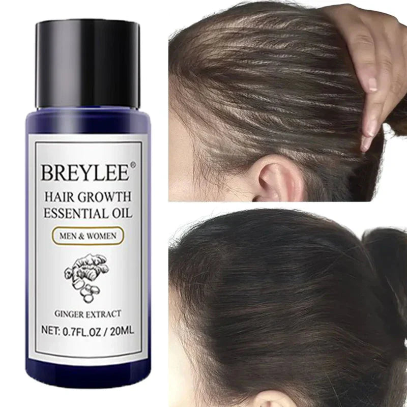 Breylee Ginger Hair Growth Essential Oil Prevent Hair