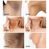 Whitening Cream For Dark Skin Underarm Bleaching Armpit