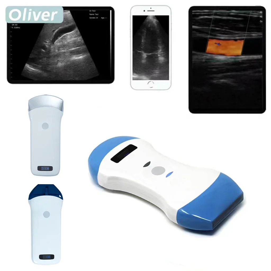 Wireless Ultrasound Probe Scanner Portable Bluetooth Machine Wifi