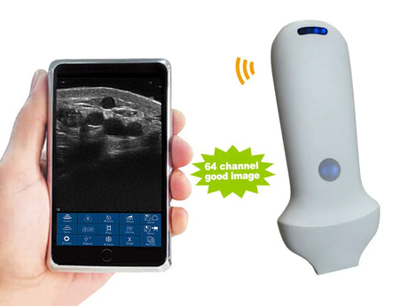 Wireless Ultrasound Probe Scanner Portable Bluetooth Machine Wifi